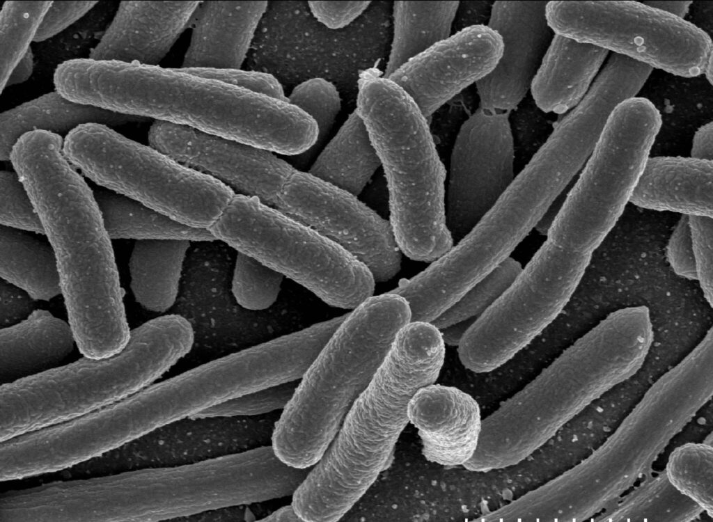  e coli bacteria, an NDM-CRE that infection control can be successful against